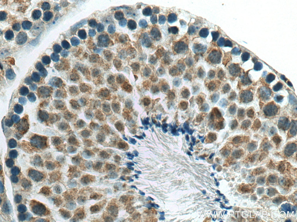 IHC staining of mouse testis using 10321-1-AP