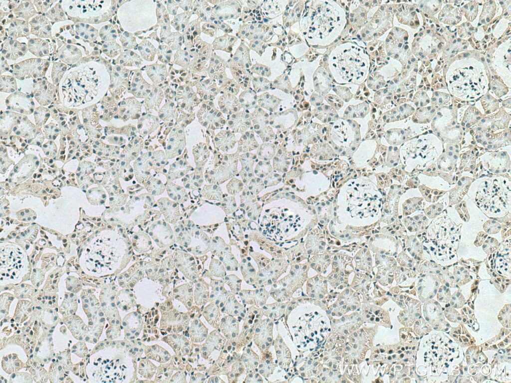 Immunohistochemistry (IHC) staining of mouse kidney tissue using PPP2R4 Polyclonal antibody (10321-1-AP)