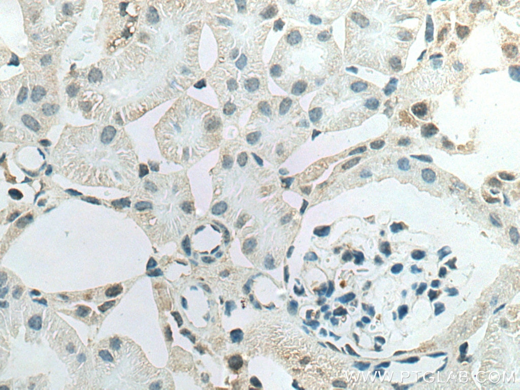 Immunohistochemistry (IHC) staining of mouse kidney tissue using PPP2R4 Polyclonal antibody (10321-1-AP)