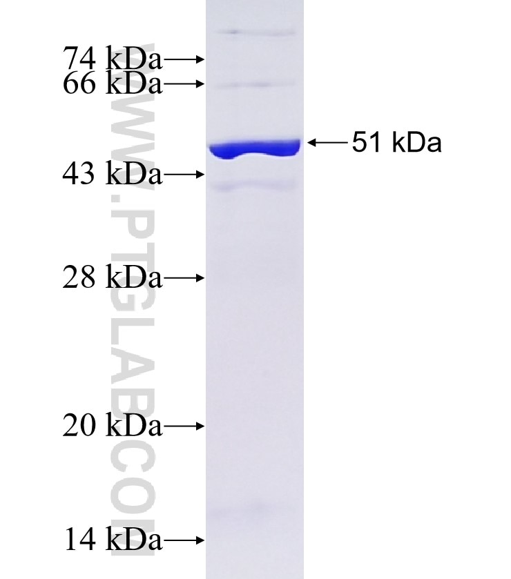 PP2A fusion protein Ag0392 SDS-PAGE