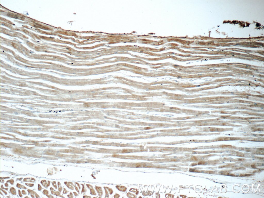 IHC staining of human heart using 14985-1-AP