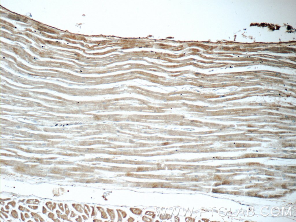 Immunohistochemistry (IHC) staining of human heart tissue using PPA1 Polyclonal antibody (14985-1-AP)