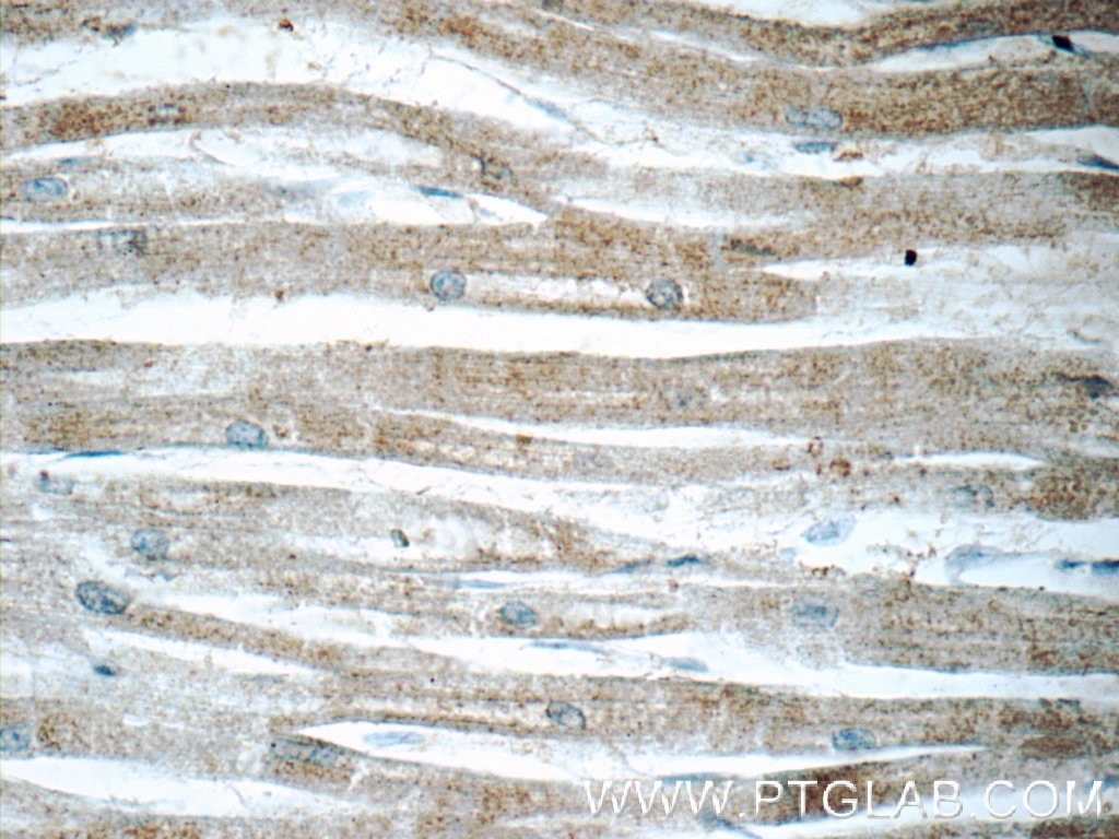 Immunohistochemistry (IHC) staining of human heart tissue using PPA1 Polyclonal antibody (14985-1-AP)