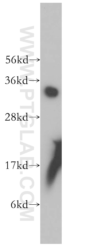 Western Blot (WB) analysis of human liver tissue using PPA1 Polyclonal antibody (14985-1-AP)
