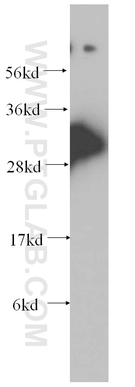 Western Blot (WB) analysis of human liver tissue using PPA1 Polyclonal antibody (14985-1-AP)