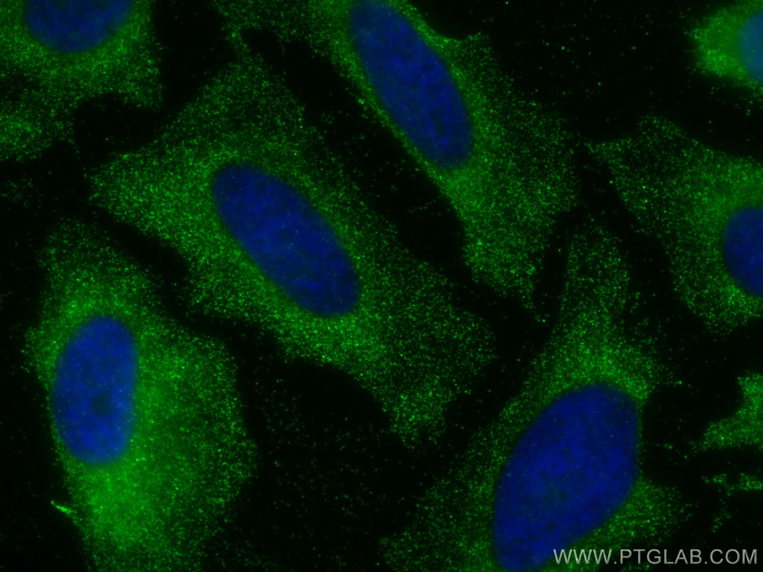 Immunofluorescence (IF) / fluorescent staining of HeLa cells using PPA1 Monoclonal antibody (68178-1-Ig)