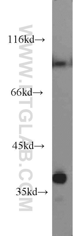 Western Blot (WB) analysis of mouse kidney tissue using PPA2 Polyclonal antibody (16662-1-AP)