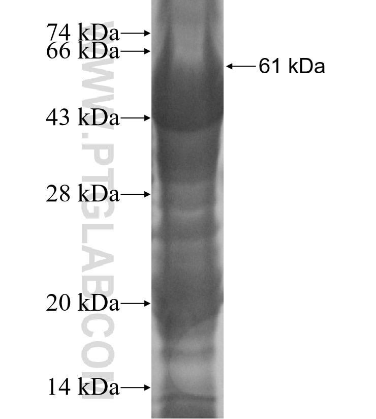 PPA2 fusion protein Ag10138 SDS-PAGE