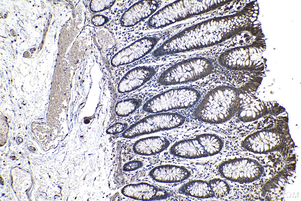 Immunohistochemistry (IHC) staining of human colon tissue using PPAN Polyclonal antibody (11006-1-AP)