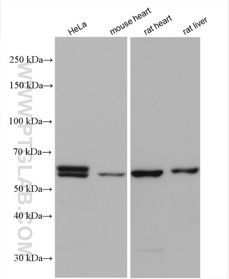 Western Blot (WB) analysis of various lysates using PPAN Polyclonal antibody (11006-1-AP)