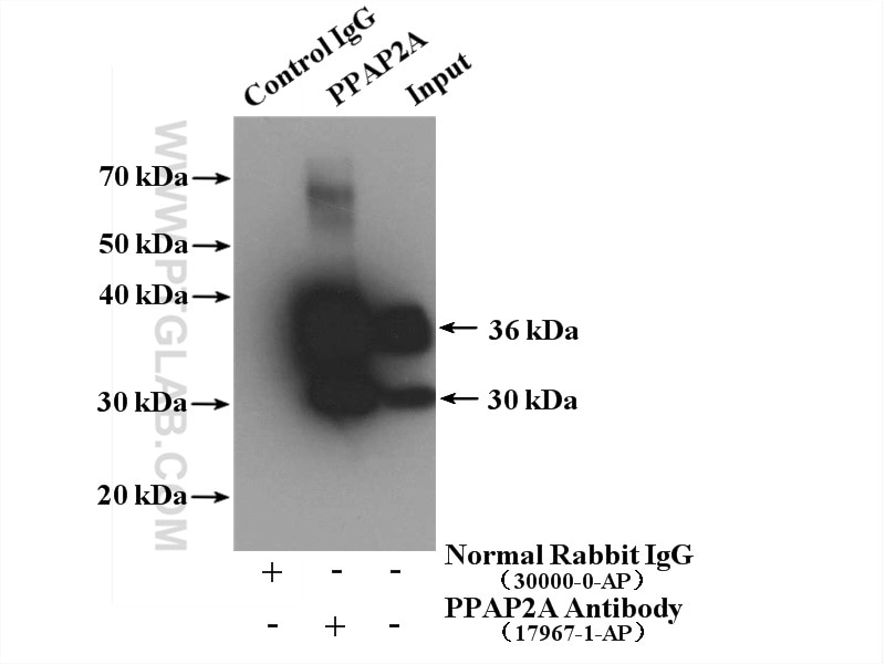 Immunoprecipitation (IP) experiment of LNCaP cells using PPAP2A Polyclonal antibody (17967-1-AP)