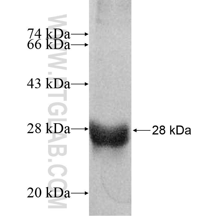 PPAP2A fusion protein Ag11615 SDS-PAGE