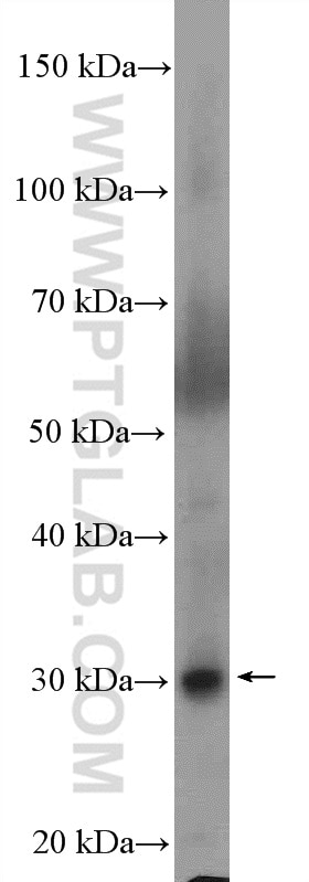 Western Blot (WB) analysis of mouse liver tissue using PPAP2C Polyclonal antibody (10451-1-AP)