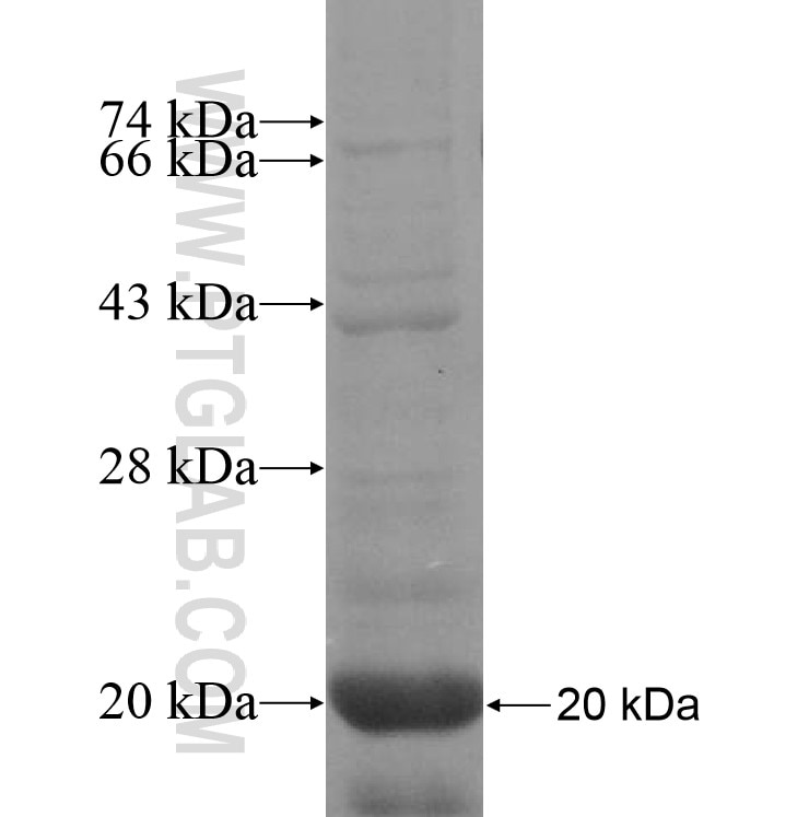 PPAPDC1B fusion protein Ag10829 SDS-PAGE