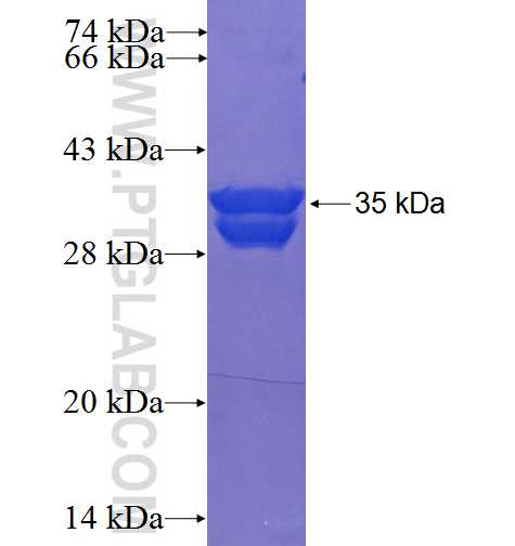PPAPDC2 fusion protein Ag23856 SDS-PAGE