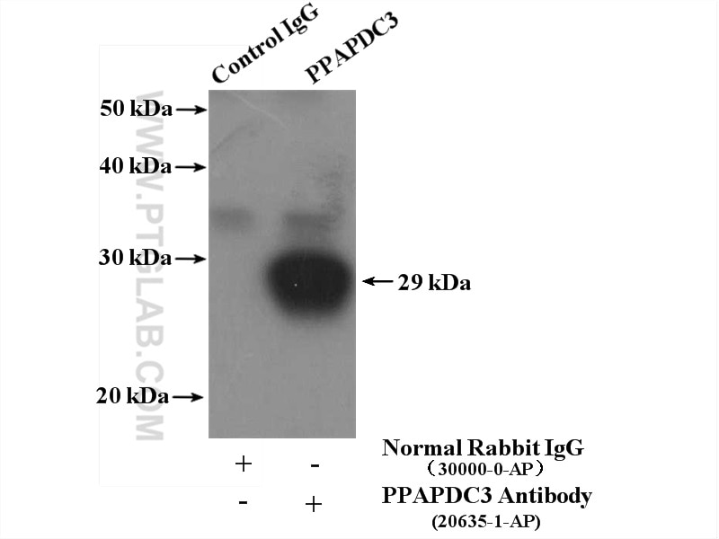 Immunoprecipitation (IP) experiment of mouse skeletal muscle tissue using PPAPDC3 Polyclonal antibody (20635-1-AP)