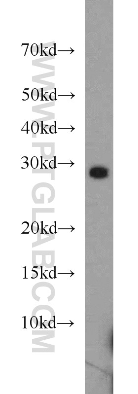 Western Blot (WB) analysis of mouse skeletal muscle tissue using PPAPDC3 Polyclonal antibody (20635-1-AP)