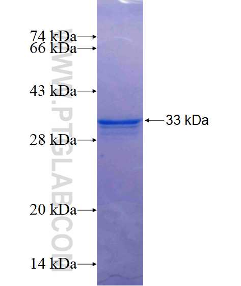 PPAPDC3 fusion protein Ag14676 SDS-PAGE
