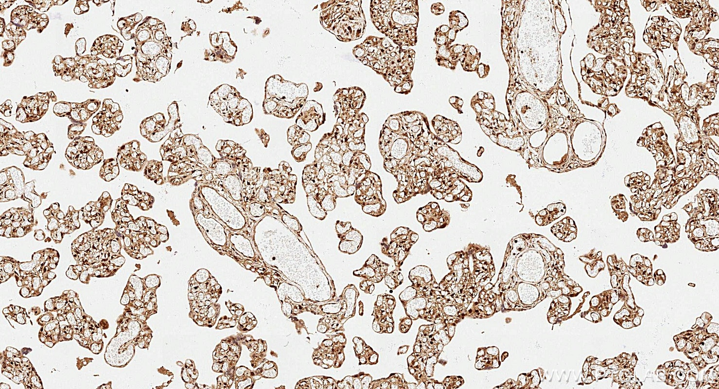 Immunohistochemistry (IHC) staining of human placenta tissue using PPAR Gamma Recombinant monoclonal antibody (81490-5-RR)