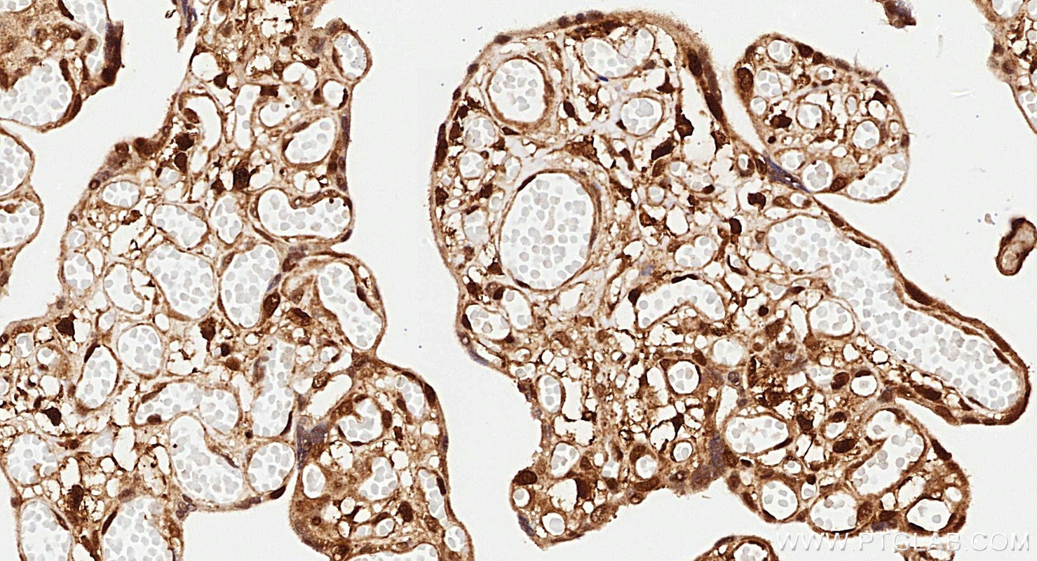 Immunohistochemistry (IHC) staining of human placenta tissue using PPAR Gamma Recombinant monoclonal antibody (81490-5-RR)