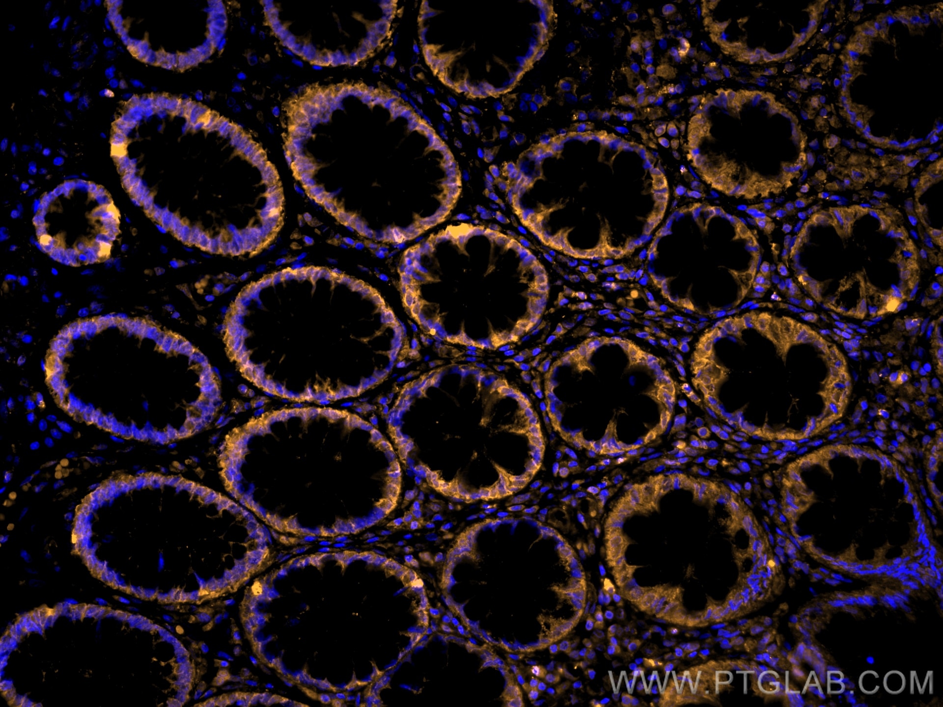 Immunofluorescence (IF) / fluorescent staining of human colon tissue using CoraLite®555-conjugated PPAR Gamma Monoclonal anti (CL555-60127)