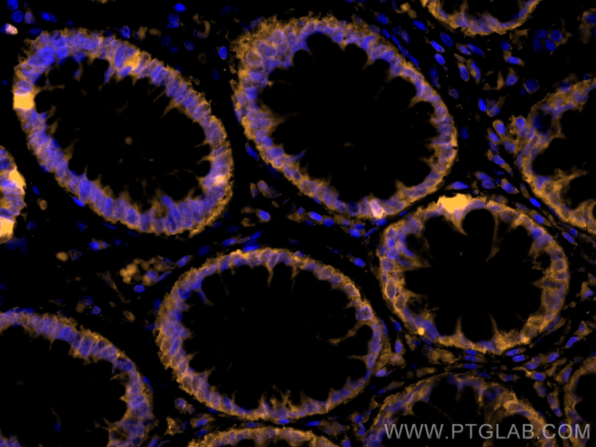 Immunofluorescence (IF) / fluorescent staining of human colon tissue using CoraLite®555-conjugated PPAR Gamma Monoclonal anti (CL555-60127)