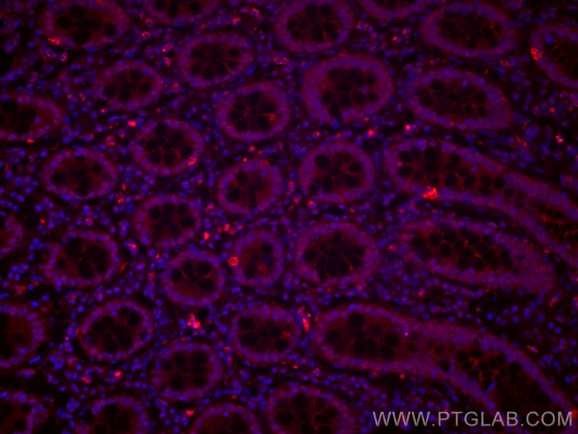 Immunofluorescence (IF) / fluorescent staining of human colon tissue using CoraLite®594-conjugated PPAR gamma Monoclonal anti (CL594-60127)