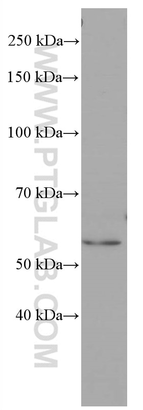 Western Blot (WB) analysis of HeLa cells using PPARA Monoclonal antibody (66826-1-Ig)