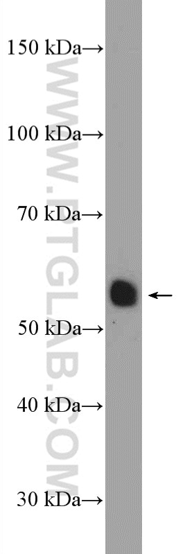 Western Blot (WB) analysis of mouse heart tissue using PPARD Polyclonal antibody (10156-2-AP)