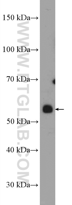 Western Blot (WB) analysis of mouse heart tissue using PPARD Polyclonal antibody (10156-2-AP)