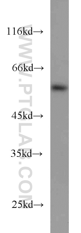 Western Blot (WB) analysis of COLO 320 cells using PPARD Polyclonal antibody (10156-2-AP)