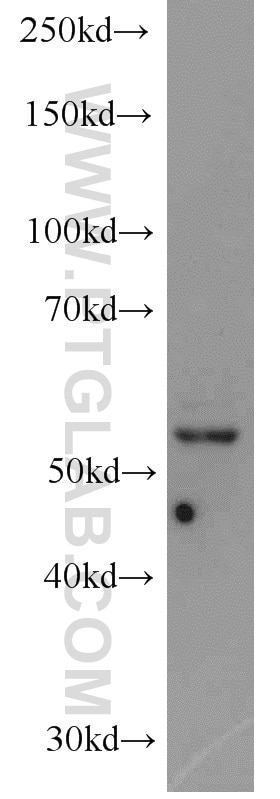 Western Blot (WB) analysis of COLO 320 cells using PPARD Polyclonal antibody (10156-2-AP)