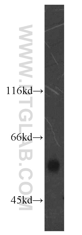 Western Blot (WB) analysis of COLO 320 cells using PPARD Polyclonal antibody (10156-2-AP)