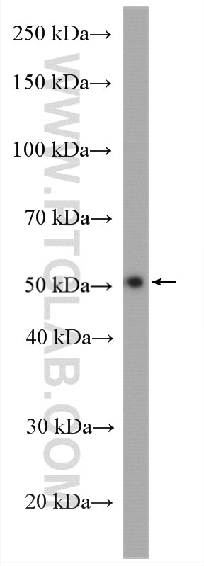 Western Blot (WB) analysis of human placenta tissue using PPARD Polyclonal antibody (28053-1-AP)
