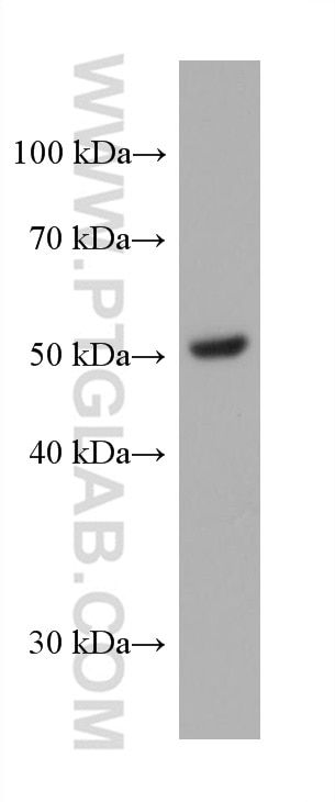Western Blot (WB) analysis of pig adipose tissue using PPARD Monoclonal antibody (60193-1-Ig)