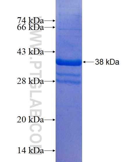 PPARD fusion protein Ag17135 SDS-PAGE