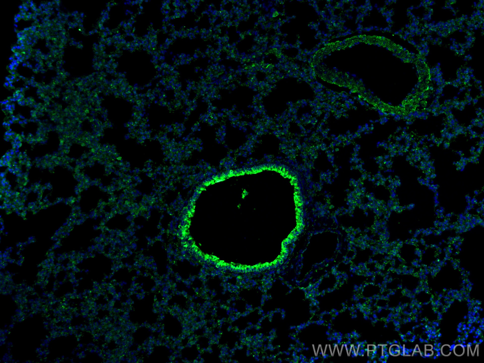 IF Staining of mouse lung using 16643-1-AP