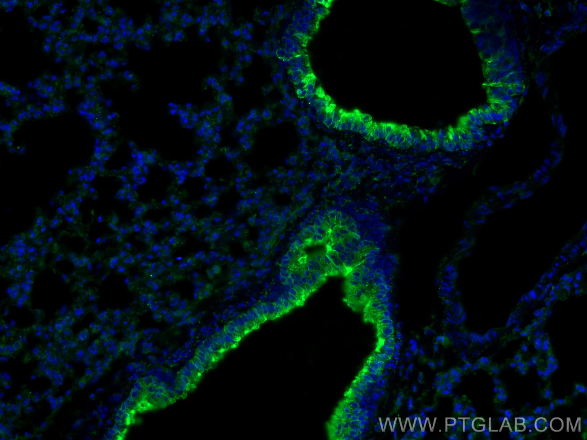 Immunofluorescence (IF) / fluorescent staining of mouse lung tissue using PPAR Gamma Polyclonal antibody (16643-1-AP)