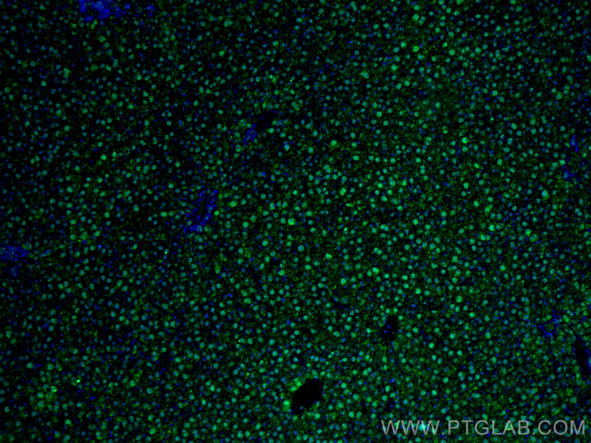 Immunofluorescence (IF) / fluorescent staining of rat liver tissue using PPAR Gamma Polyclonal antibody (16643-1-AP)