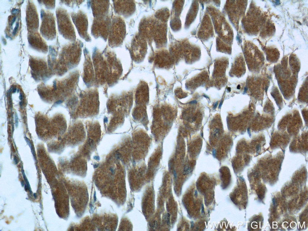 PPAR Gamma Polyclonal antibody