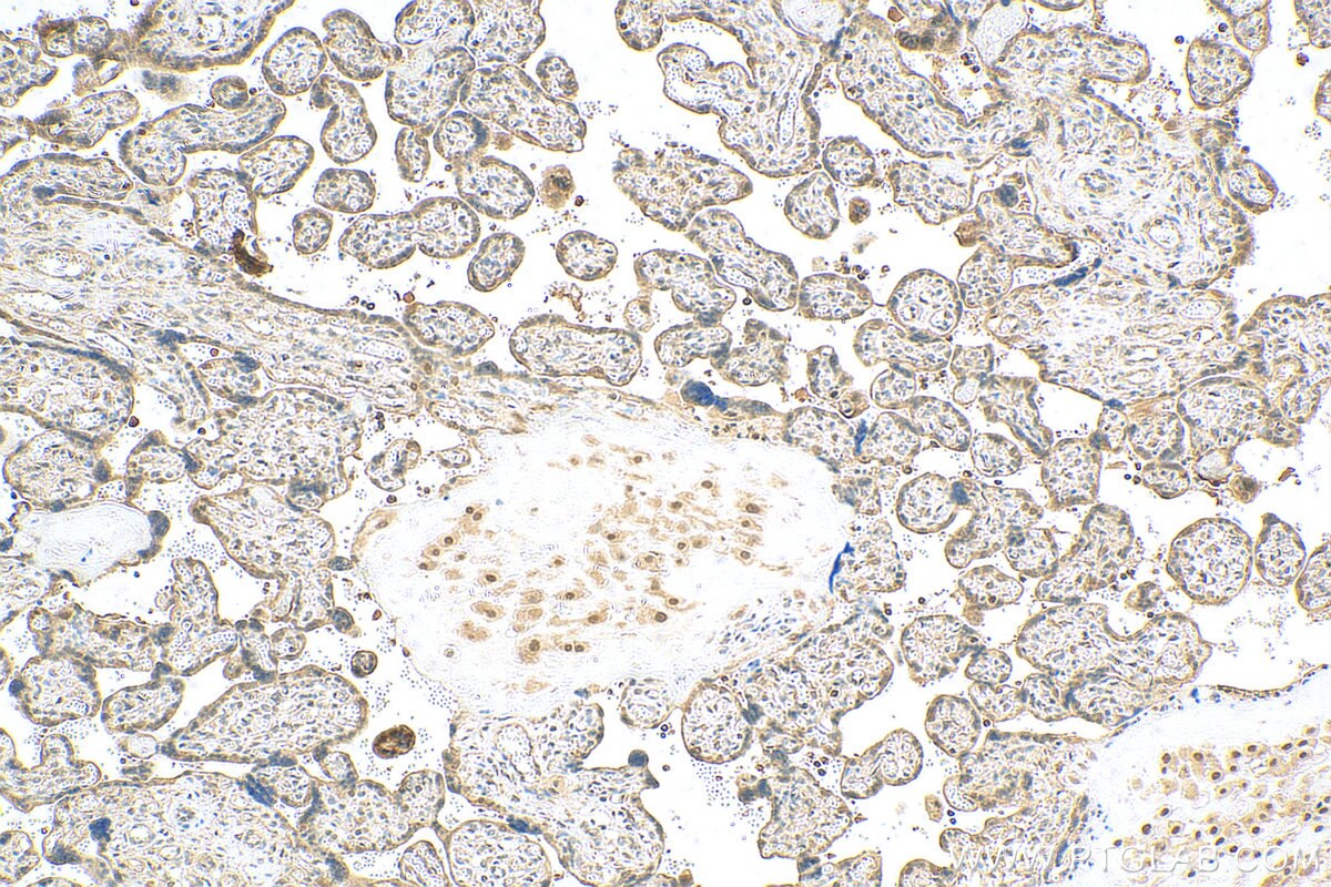 Immunohistochemistry (IHC) staining of human placenta tissue using PPAR Gamma Polyclonal antibody (16643-1-AP)