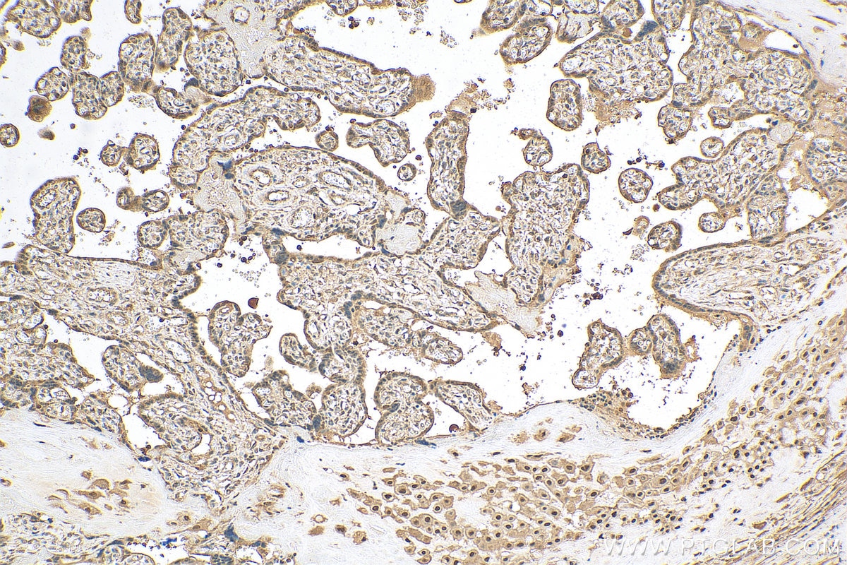 Immunohistochemistry (IHC) staining of human placenta tissue using PPAR Gamma Polyclonal antibody (16643-1-AP)