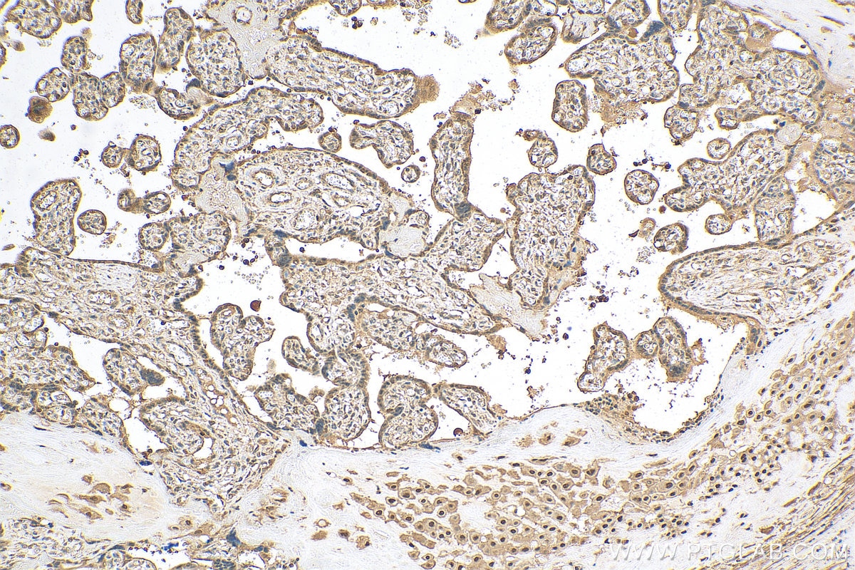 IHC staining of human placenta using 16643-1-AP