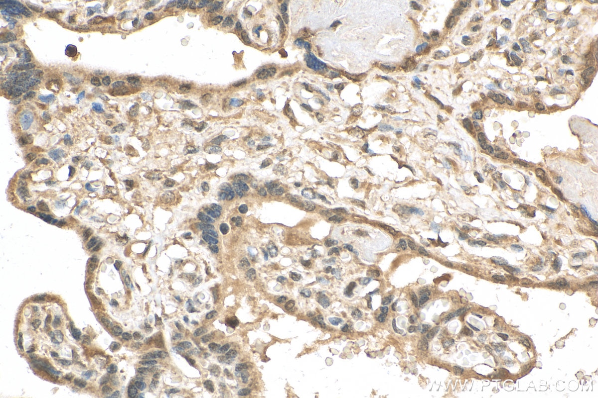 Immunohistochemistry (IHC) staining of human placenta tissue using PPAR Gamma Polyclonal antibody (16643-1-AP)