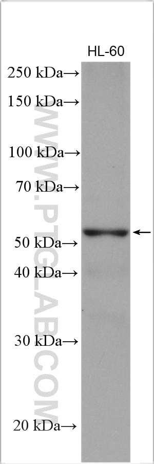 Western Blot (WB) analysis of various lysates using PPAR Gamma Polyclonal antibody (16643-1-AP)