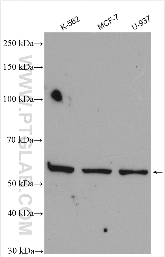 Western Blot (WB) analysis of various lysates using PPAR Gamma Polyclonal antibody (16643-1-AP)