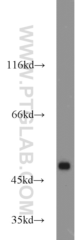 Western Blot (WB) analysis of mouse heart tissue using PPAR Gamma Polyclonal antibody (16643-1-AP)