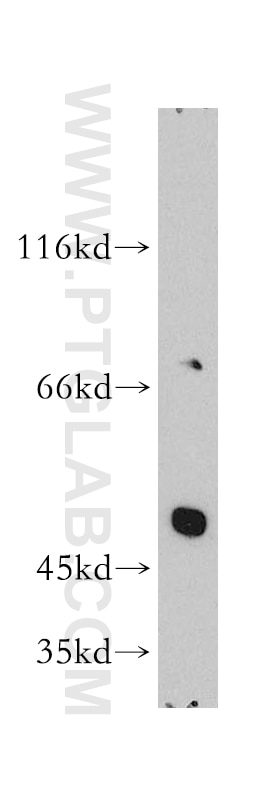 Western Blot (WB) analysis of human heart tissue using PPAR Gamma Polyclonal antibody (16643-1-AP)