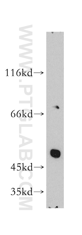 WB analysis of human heart using 16643-1-AP