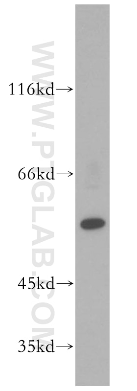 PPAR Gamma Polyclonal antibody